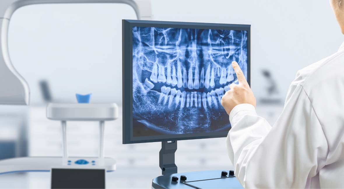 デジタルレントゲン画像をPCモニターに表示された写真