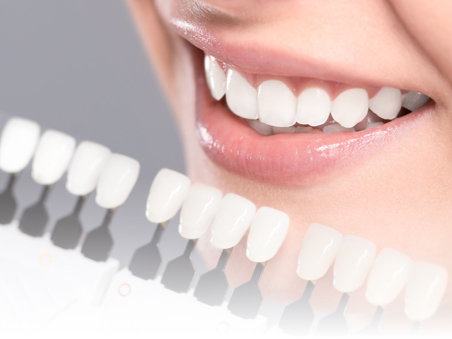 女性口元のきれいな歯と歯の白さの指標の写真